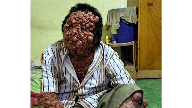 Bantu Pengobatan dan Perekonomian Pak Urip