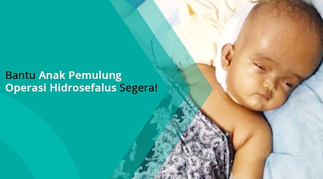 Bantu Anak Pemulung Sembuh dari Hidrosefalus