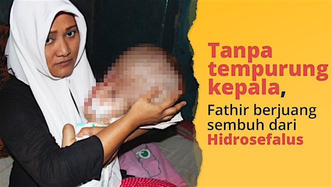 Bantu Fathir melawan Hydrocefalus