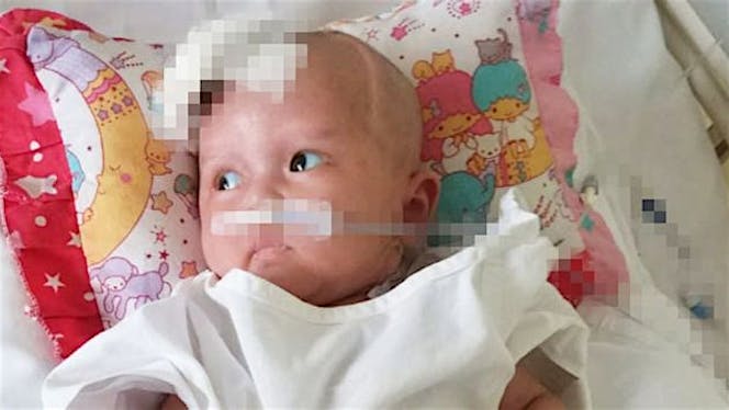 Bantu Salma Sembuh dari Cerebral Palsy