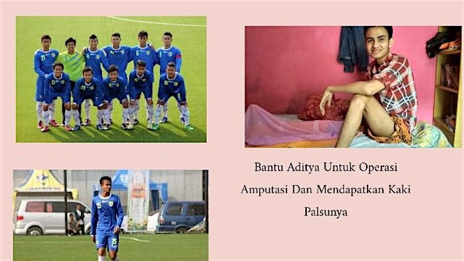 Bantu Biaya Amputasi Aditya