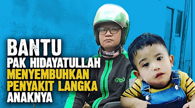 Adelio Bisa Lawan Poland Syndrome dan Moebius Synd