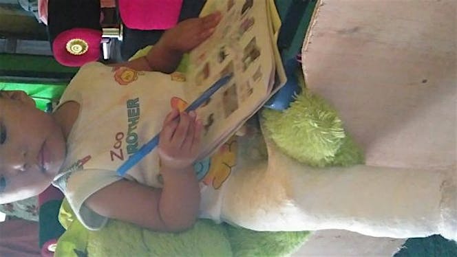 Bantu aqila untuk sembuh dari hyp dyplasia..