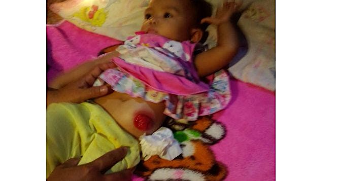 Bantu Hilda memiliki lubang anus sebagaimana mesti