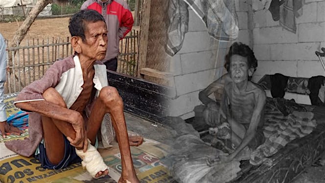 Bantu Kakek Petugas Kebersihan Kalahkan 3 Penyakit