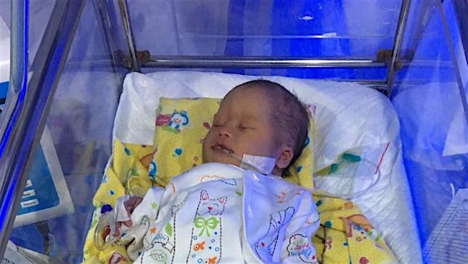 Bantu adek Bhulan lawan Atresia Ani