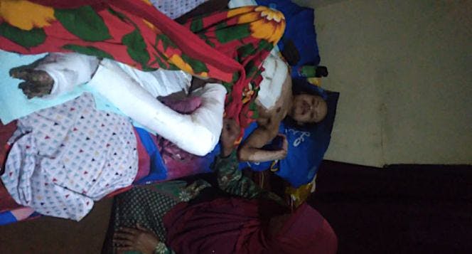 Sudah 2 tahun tersengat listrik tak kunjung sembuh