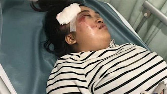 Bantu Yeni Biaya Operasi Kecelakaan
