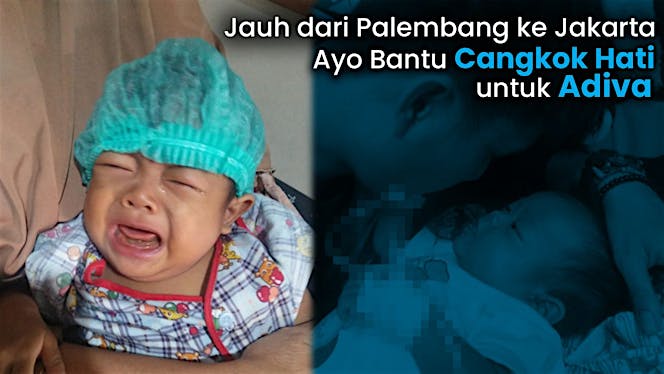 Bantu Adiva Melawan Atresia Billier