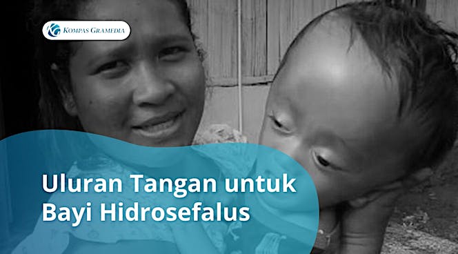 Bantu Agustinus Bayi Pengidap Hidrosefalus