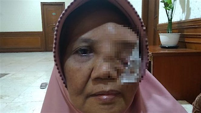 Bantu saya melawan kanker tiroid