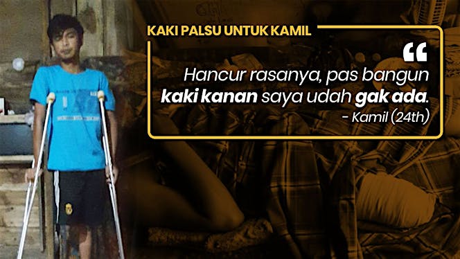 Bantu Kamil Beraktifitas Kembali Dengan Kaki Palsu