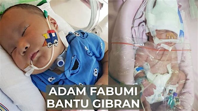 Adam Fabumi Bantu Baby Gibran Keluar dari NICU