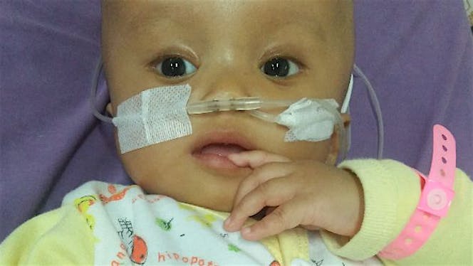 Bantu Arsyila yang sakit Hidrosefalus obsustruktif