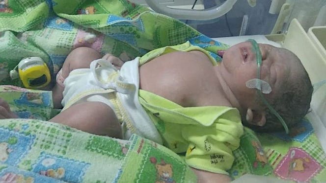Bantu Yuki Berjuang Hidup Di NICU