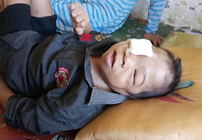 Kisah Anak Yatim Tak Mampu Obati Operasi Katarak