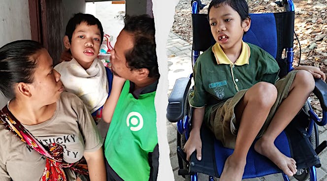 Narik Ojol Untuk Biaya Operasi Anaknya Lumpuh Otak