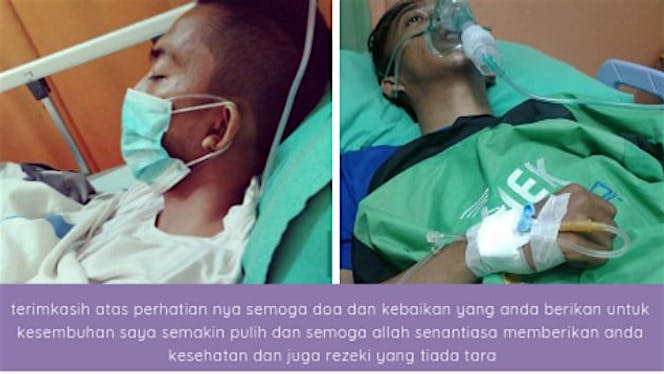 bantu muhammad andi indikasi paru paru