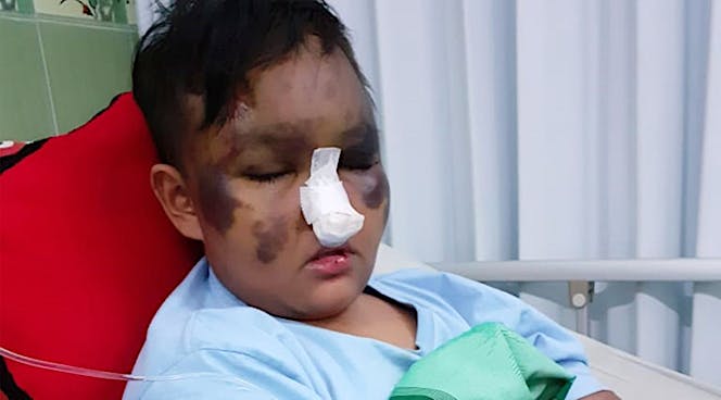 URGENT! Hanif Drop Karena Leukimia & ITP