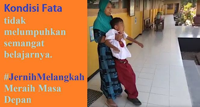 Dukung Siswa Lumpuh Tidak Berhenti Melangkah