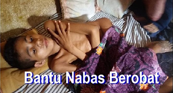 Bantu Nabas Berobat