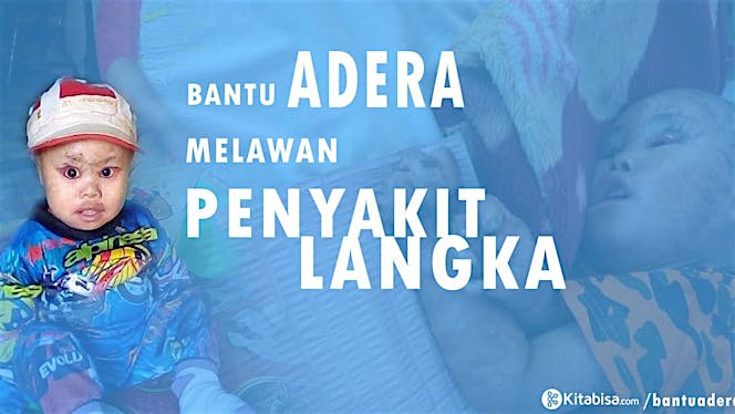 Bantu Adera Melawan penyakit langka