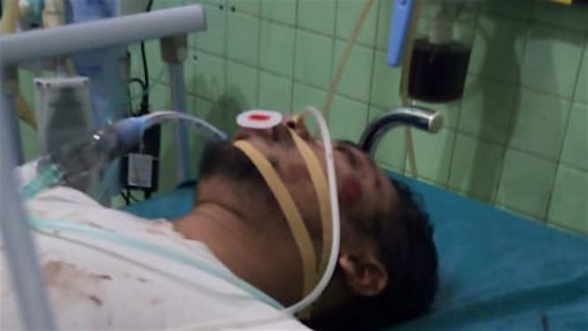 Bantu Yusup oprasi otak demi kmbali menafkahi anak