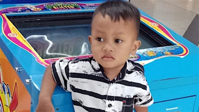 Bantu abil untuk operasi tempurung kepala