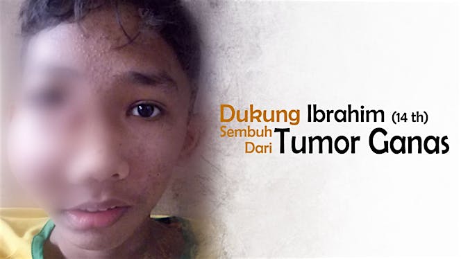Yuk, Bantu Ibrahim Sembuh Dari Tumor Ganas!