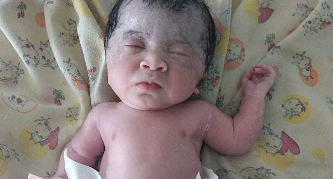 Bantu Maryam penderita oi untuk sembuh