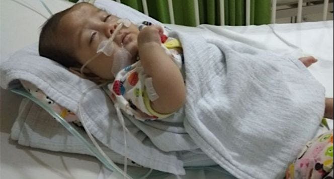 Bantu Kenzie operasi Atresia Esofagus
