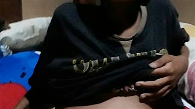 Adik Miftahul Sulhi penderita rematik jantung