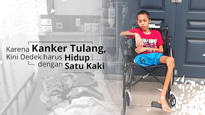 Bantu Dedek Melawan Kanker di kakinya