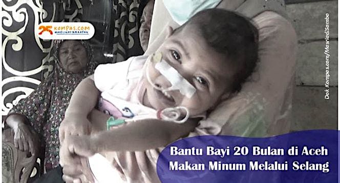 Kisah Pilu Bayi di Aceh Makan Minum Melalui Selang