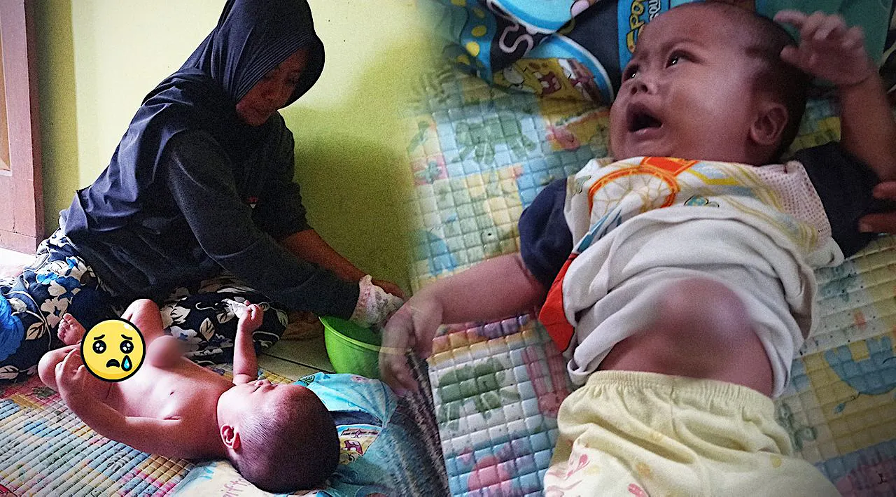 Kisah Pilu Bayi 8 Bulan Lawan 3 Penyakit Ganas!