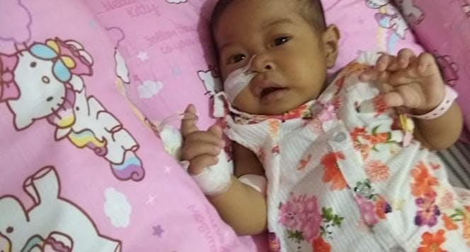 bantu adik eksa lawan penyakit atresia bilier