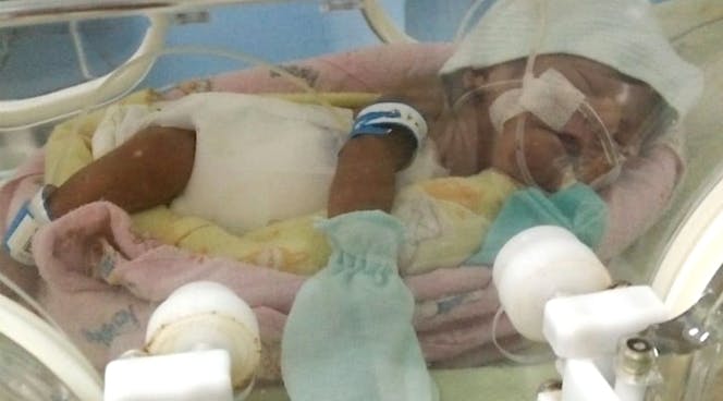 Chairil, Berjuang di NICU Demi Saudara Disurga