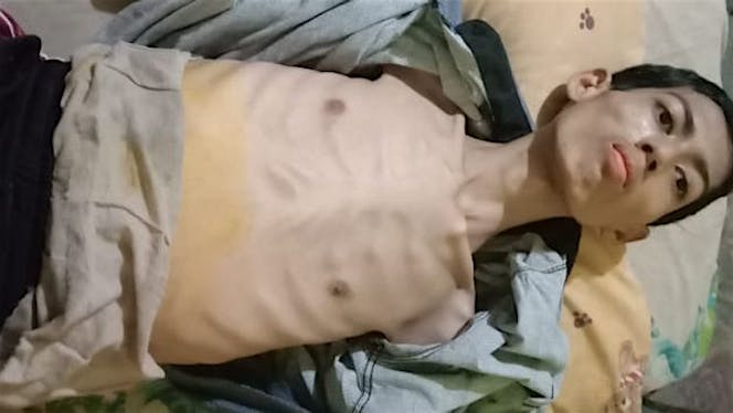Bantu Sulaiman Jalani Operasi Tumor Usus dan Ginja