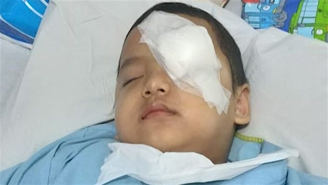 Adik Farih 4 Tahun Melawan Kanker Mata