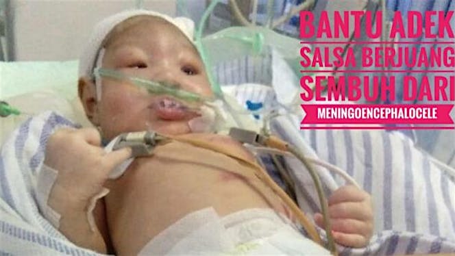 Bantu Salsa berjuang dari meningoencephalocele