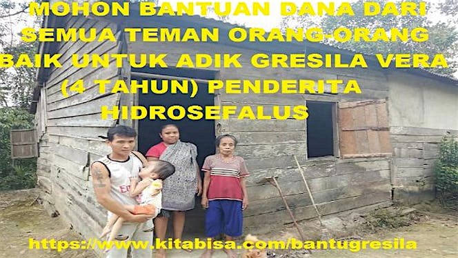 Bantu GRESILA VERA 4 Tahun Melawan HIDROSEFALUS