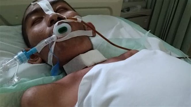 spirit ficco for Guillain-Barré syndrome (GBS)