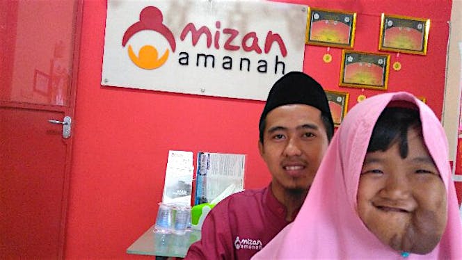 Bantu anak yatim (Chila) operasi tumor.