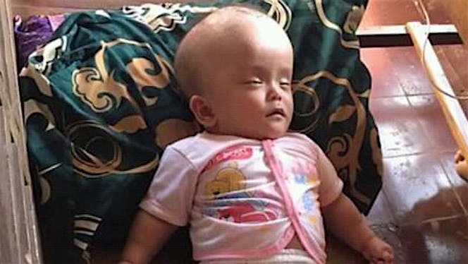 Bantu kami untuk oprasi anak kami