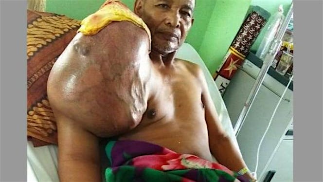 Bantu Pak Yoyo untuk sembuh