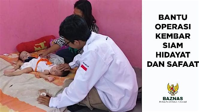 Bantu Operasi Kembar Siam Hidayat dan Safaat