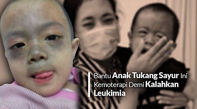 Bantu Guntur, Anak Tukang Sayur Lawan Leukimia