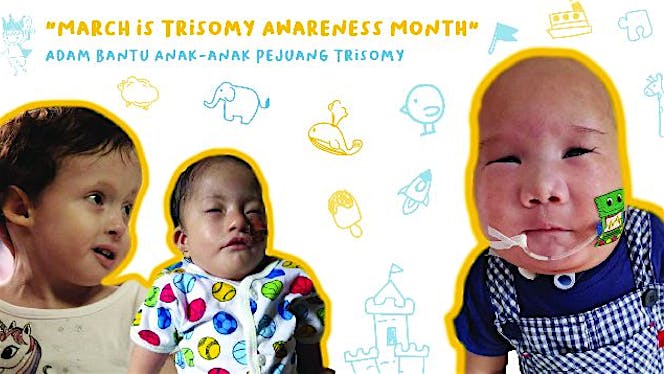 Dari Adam untuk Anak-anak Pejuang Trisomy