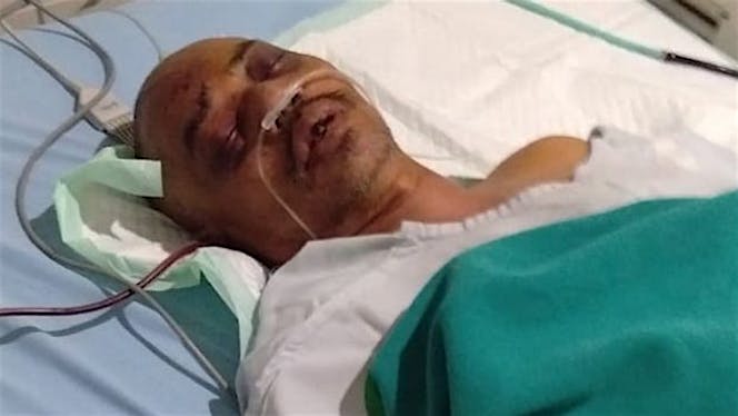 Bantu Operasi Pendarahan Otak Bapak Sukir Siswanto