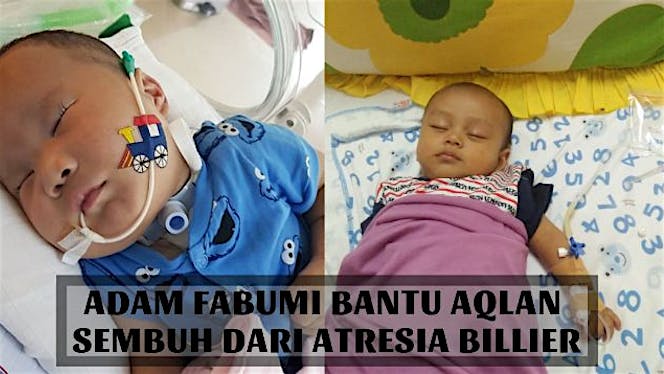 Adam Fabumi Bantu Aqlan Sembuh dari Atresia Bilier
